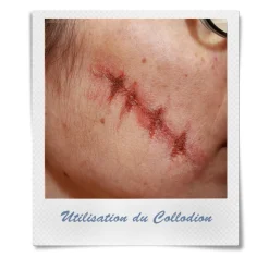 COLLE LIQUIDE COLLODION 11ML