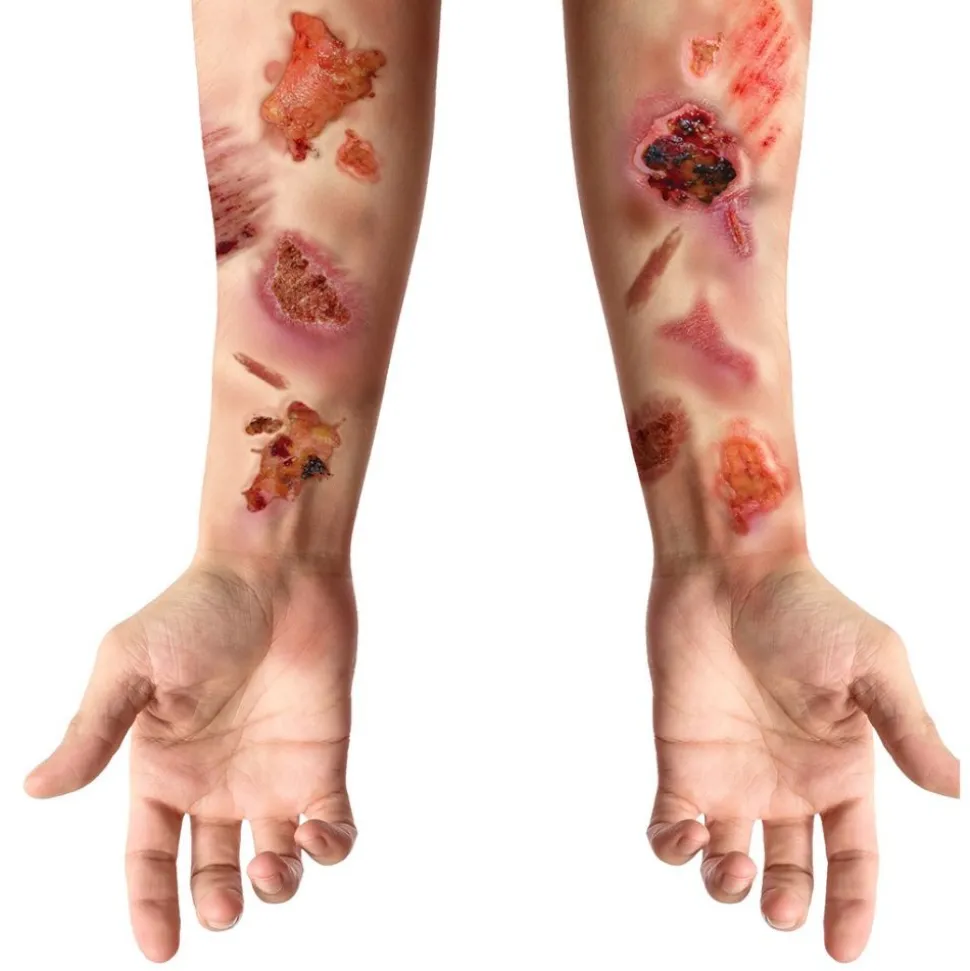 TATOUAGES ÉPHÉMÈRES BLESSURES PLAIES INFECTÉES